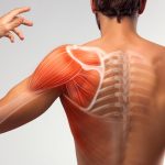 Frozen Shoulder Donuk Omuz - Dr Yalın Dirik
