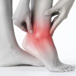 Halluks Valgus - Ayak Bileği - Dr Yalın Dirik