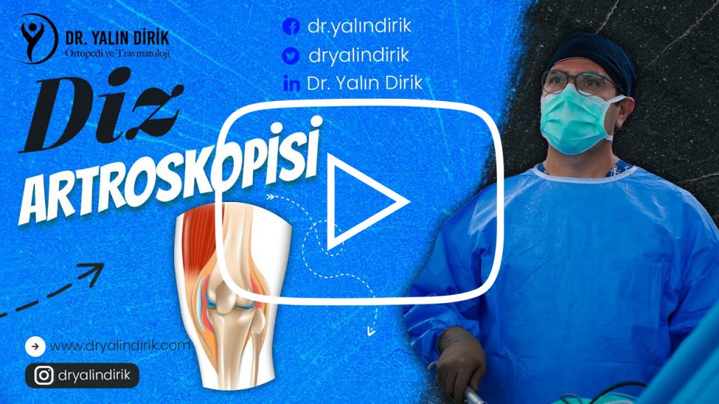 Dr Yalın Dirik diz artroskopisi